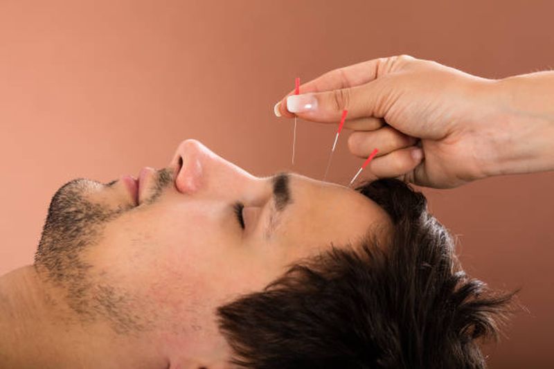 Express Yourself – Facial Acupuncture
