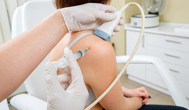 Steroid Injection Therapy