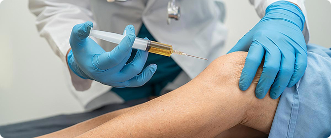 PRP Treatment
