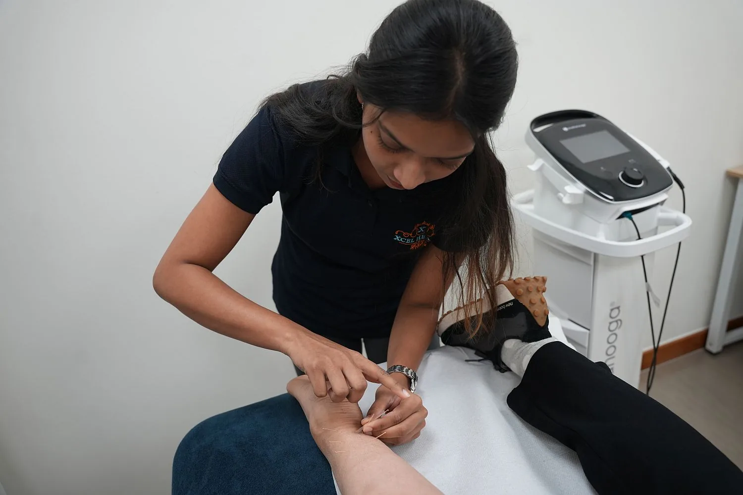 Acupuncture